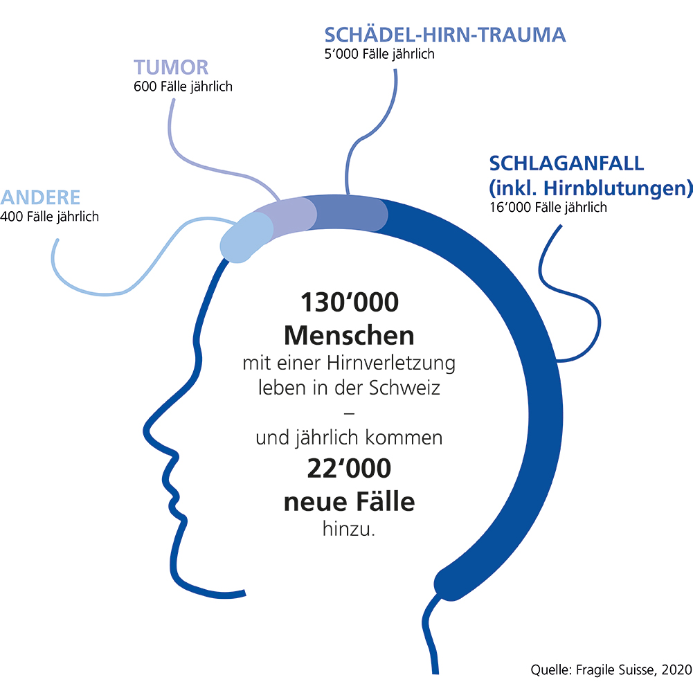 FRAGILE_Suisse's tweet photo. 💡 Wie häufig sind Hirnverletzungen in der Schweiz? Und was sind die häufigsten Ursachen? Diese kleine Infografik gibt Antworten auf diese Fragen. https://t.co/jvmf1heEsJ