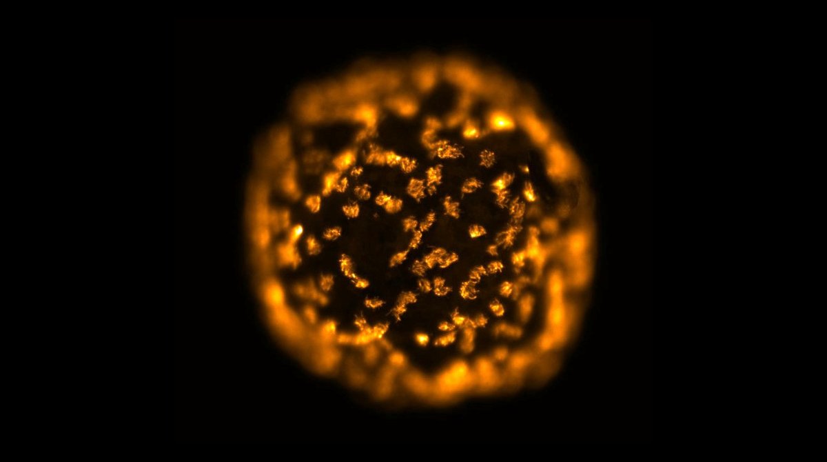 Individual xenobot developed into a sphere covered in cilia