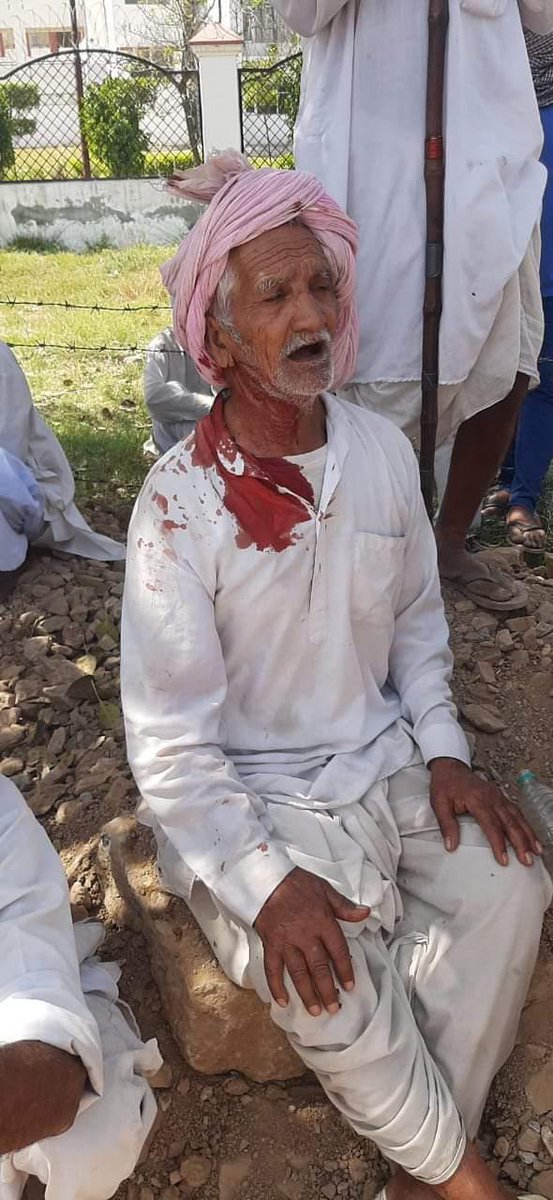 मोदी जी इस खून की एक एक बूंद का हिसाब आपको देना पड़ेगा।क्यो की समय जरूर बदलता हैं,इतिहास इस बात का साक्षी है।
कब तक EVM से प्रधानमंत्री बनोंगे।