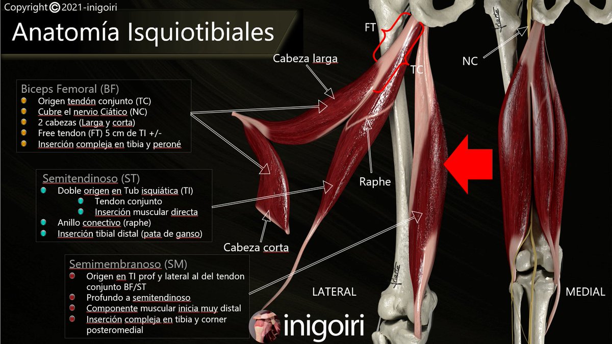 Aqui os comparto unos esquemas anatómicos de los isquiosurales. Espero que os guste.
Recordaros a aquellos que os apasione la anatomía y la ecografía musculoesqueléticas que tenéis a vuestra disposicion mi canal de YouTube
youtube.com/c/inigoiri?sub…