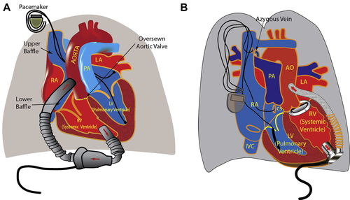SeguraCardio's tweet photo. 📌Advanced #HeartFailure in Adults w/ Congenital Heart Disease #StateOfTheArt 📝 @JACCJournals 
#CardioEd #CardioTwitter https://t.co/A0YZOPWBFr