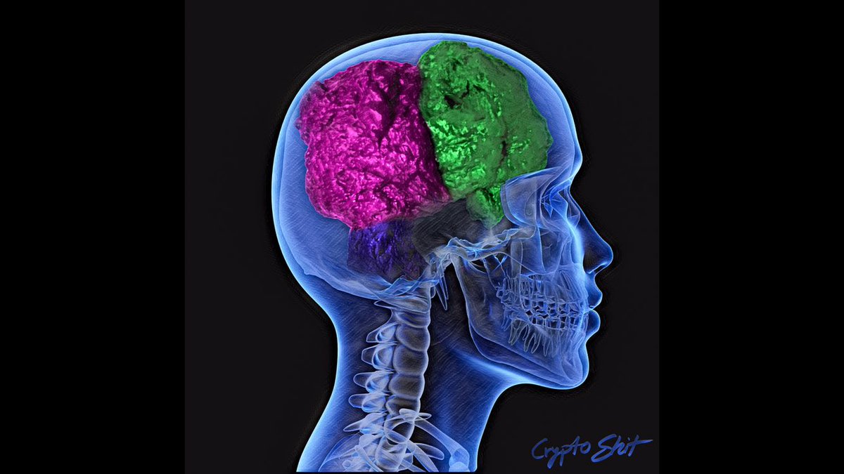 CryptoShitArt's tweet photo. We all know that someone, who is just sooo full of it!!

Find „Shithead“ on https://t.co/RBia7ctp6Q - Link in bio! 💩🗣
.                                              
#animalShit #cryptoShit #nft #cryptoArt #shithead #nftCommunity #nftArtist #vra #hot #btc #eth #flow https://t.co/dk7gTGZcFo