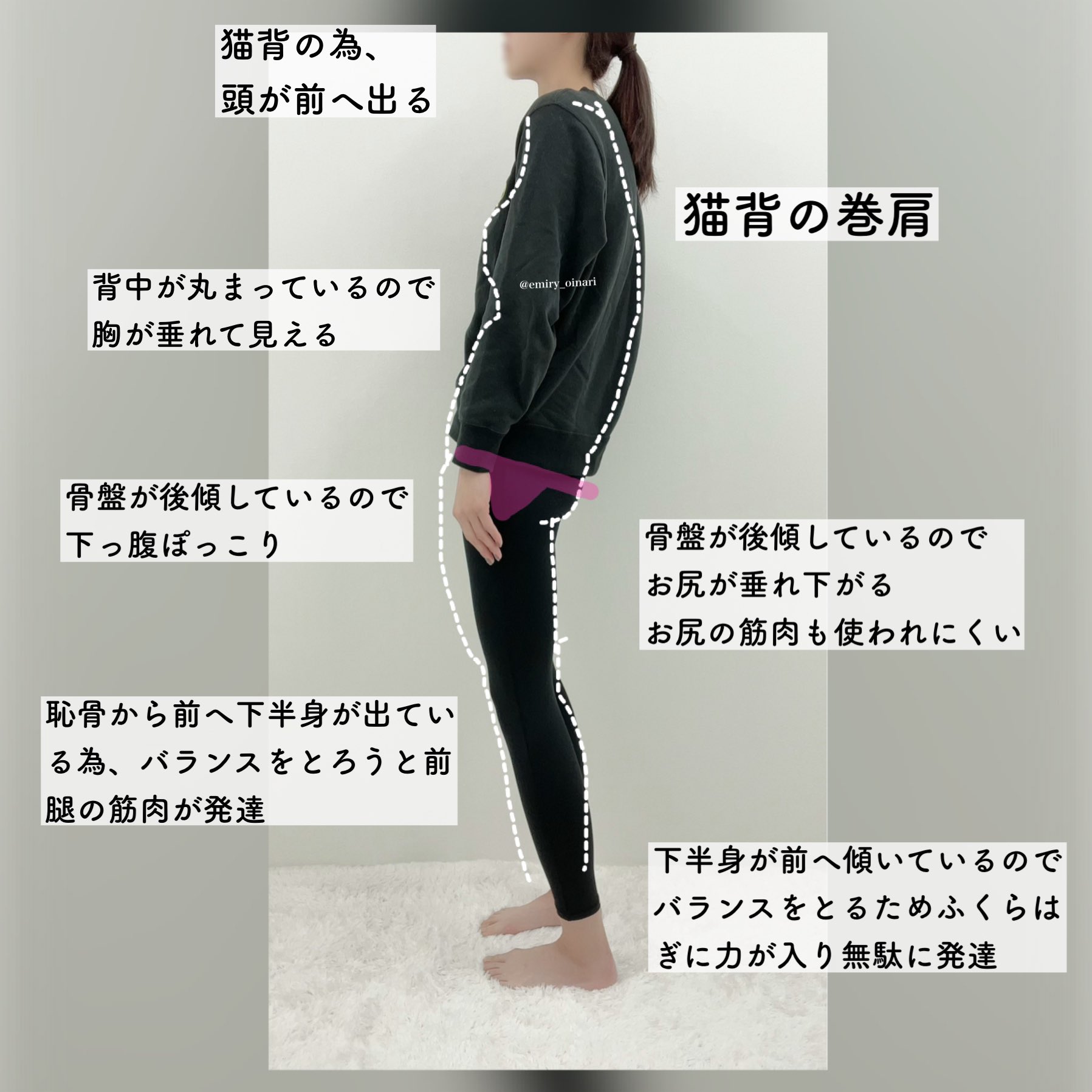 トレえみ 骨盤前傾の反り腰姿勢の人の次は骨盤後傾猫背さんver です この姿勢の人もよく見かけます ストレッチを続けることで 姿勢が正しやすくなるのでやってみて下さい ストレッチ後は真っ直ぐ立ちやすくなっているので やる前と後で比べてみて