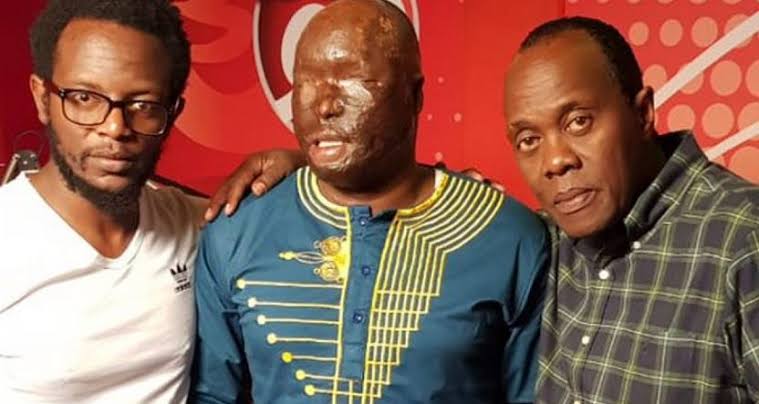 Kenyan man defaced and blinded after a woman poured acid on his face #stopkillingmen