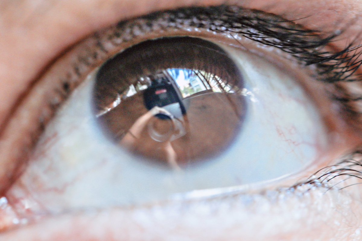 spleendevivir's tweet photo. Pasaron muchos aΓ±os para llegar aquΓ pero aquΓ estamos π.π #Canon #canonmacro #canon100mm #macroeye https://t.co/YffS3nBIG9
