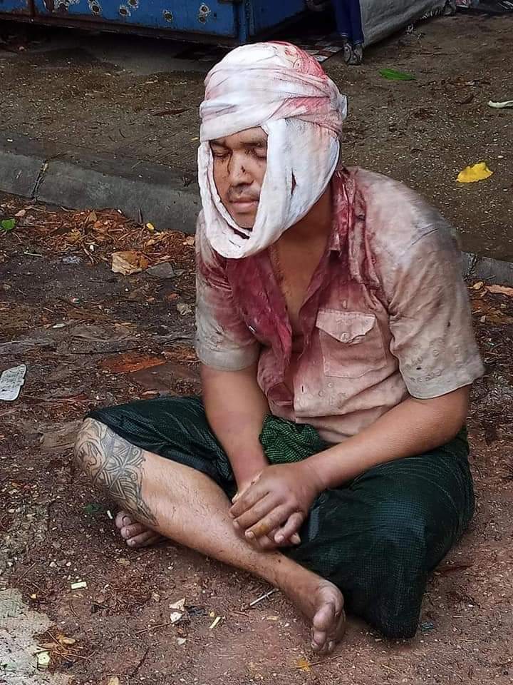 emmy_from's tweet photo. ทหารเอามาทิ้งไว้ข้างถนน
พี่เค้าน่าสงสารมาก😥😥😥
#WhatIsHappeningInMyanmar
#PleaseHelpMyanMar
#savethepeopleinmyanmar https://t.co/TrSPtMYTcW