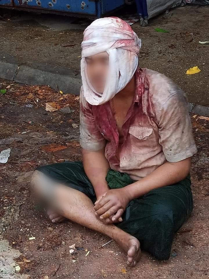 #Apr5Coup Maha Bandula Road, Yangon
SAC junta violence: Man from Dawphon township beaten up badly around the head.
#WhatshappeningInMyanmar https://t.co/v294Q6RJVq https://t.co/JfNXC1lIYR