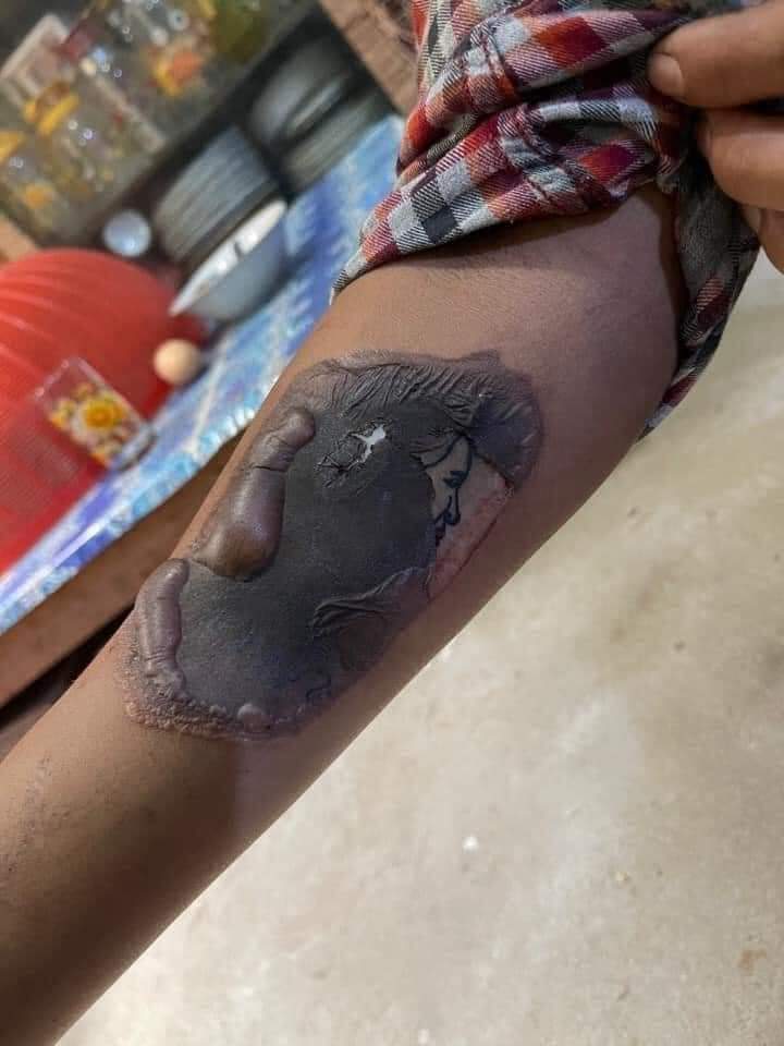 LDinity's tweet photo. The tattoo portrait of Aung San Su Kyi on people body is being burnt by Junta. They are being just jealous or unsecured. #WhatsHappeninglnMyanmar https://t.co/1rjMQW64SP
