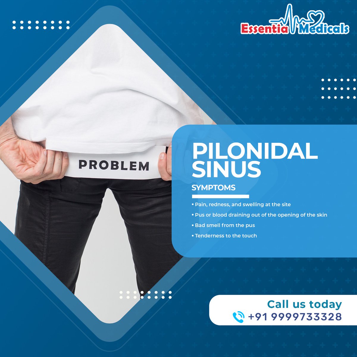 Pilonidal Sinus Symptoms
1) Pain, redness and swelling at the site
2) Pus or blood draining out of the opening of the skins
3) Bad smell from the pus
4) Tenderness to the touch
#pilonidalsinus #pilonidalcyst #pilonidalsurgery  #cistopilonidal 
Call Us @ 9999733328, 9999733325