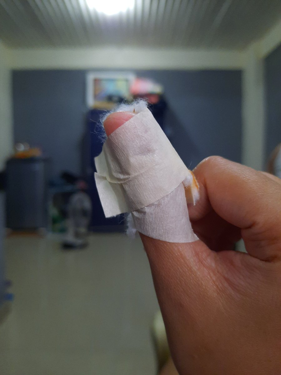 InahAlca's tweet image. Minsan na lang maghugas ng pinggan, nainjure pa 😅