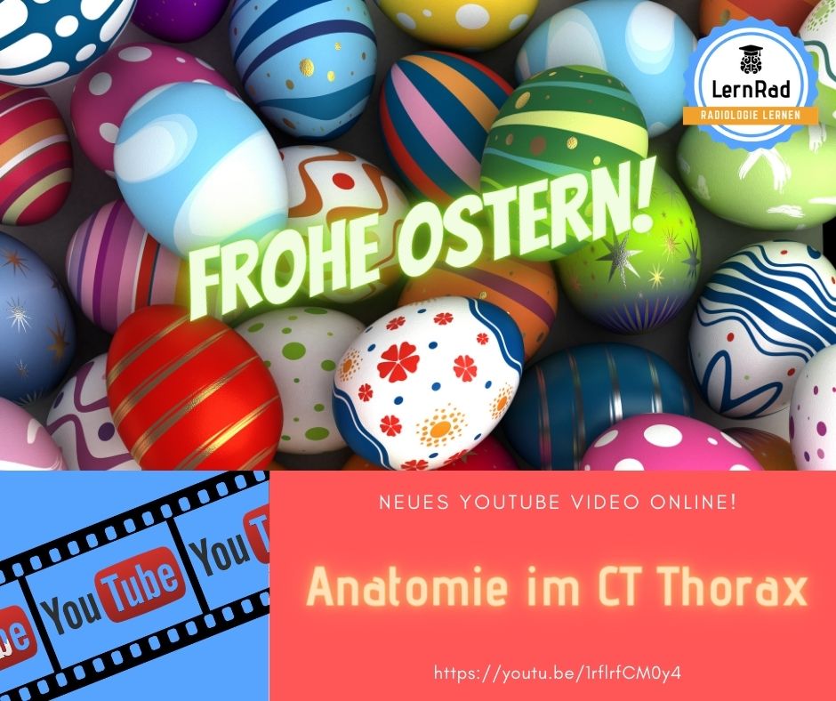 Im frisch veröffentlichten YouTube Video unserer Gründerin <a href="/Baessler_Rad/">Bettina Baeßler</a> geht es um die Anatomie in der Computertomographie des Thorax. youtu.be/1rflrfCM0y4 #radiologie #shehealth FROHE OSTERN - bleibt gesund und macht das Beste draus!