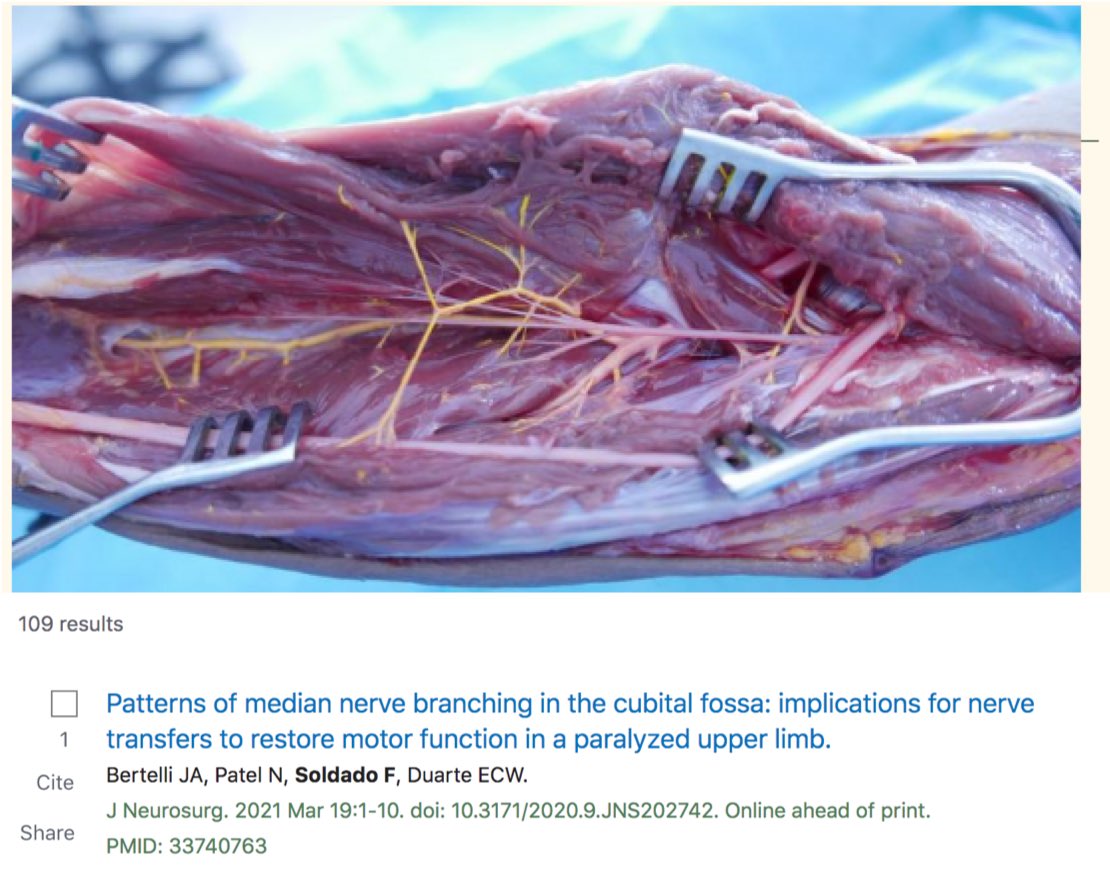 Publicación personal Pubmed #109
Colaborando con el mejor cirujano de nervio de la historia: Prof Jayme Bertelli
Anatomía del nervio mediano aplicada a transferencias nerviosas.
La anatomía es la ciencia básica principal del cirujano.