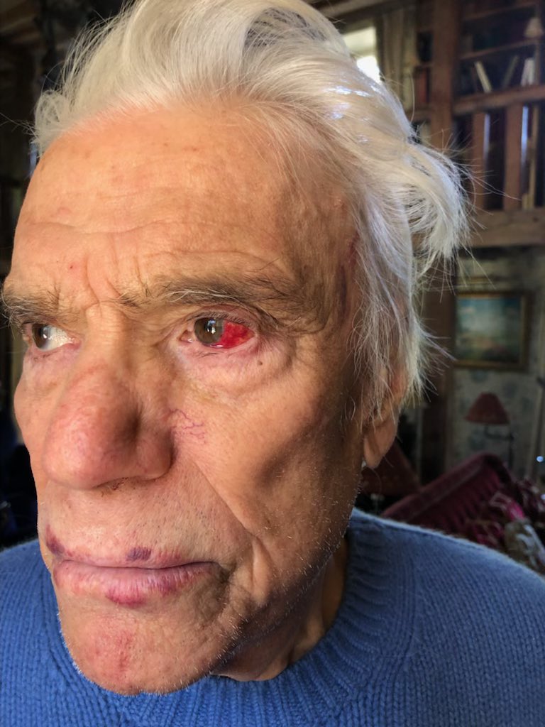 TapieStephane's tweet image. Bande de lâches que vous êtes 😡😡 Je ne vous souhaite pas que ça arrive à vos parents un jour. Regardez-vous dans un miroir et osez dire que vous n’avez pas honte de votre ignominie. J’espère que la police vous retrouvera  avant moi 😡😡