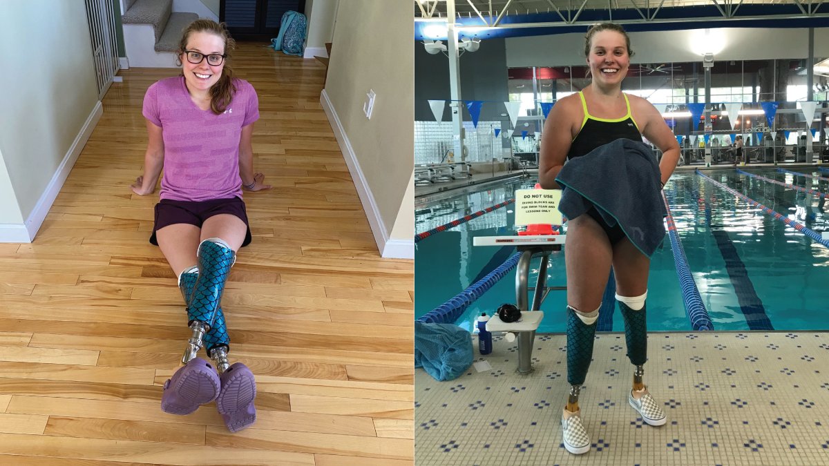 #limblosslimbdifference Awareness feature 

@morganstickney9 is a #paralympic #swimmer double #amputee #SteppingStrong patient. She underwent the groundbreaking #EwingAmputation which preserves the connection with the brain allowing for natural sensation to prosthetic joints