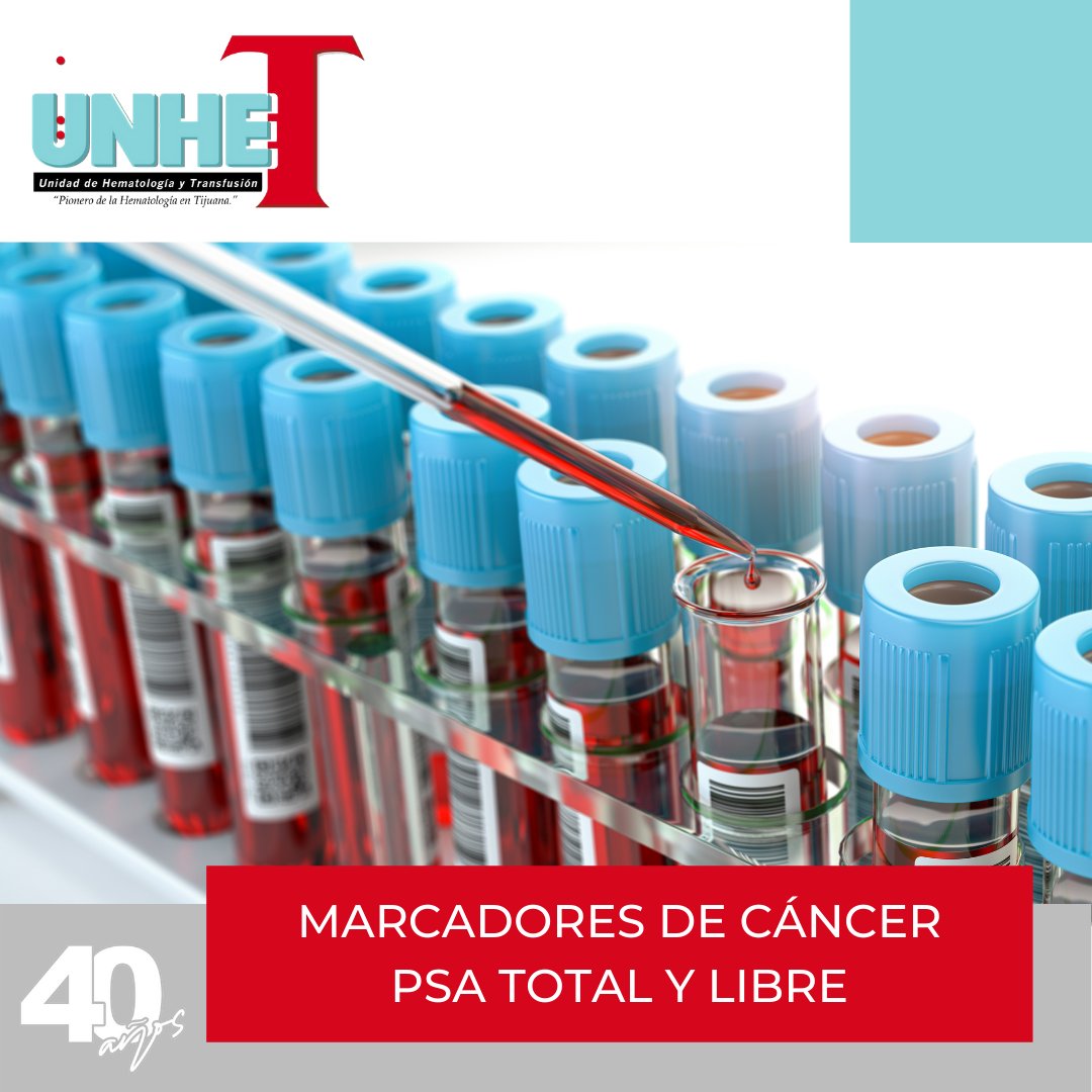 UneteLab's tweet image. Realizamos estudios especiales como Marcadores de cáncer, Antígeno Prostático Específico Total (PSA total) y Libre.

TIJUANA: Laboratorio: 📞664 103 6131
ROSARITO: Laboratorio: 📞661 124 1869
BANCO DE SANGRE: 📞 664 634 67 23 

#AnalisisClinicos #Salud #COVID #cancer