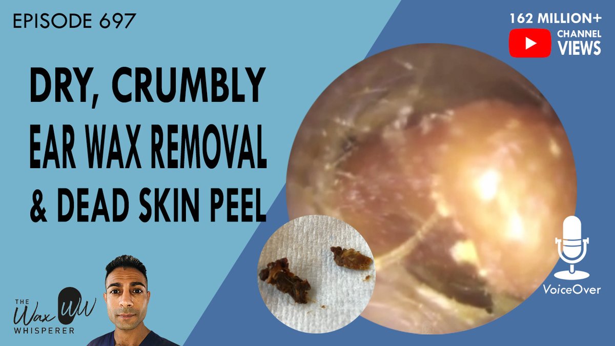 TheHearClinic's tweet photo. 697 - Dry, Crumbly Ear Wax Removal &amp; Dead Skin Peel https://t.co/LFXHvvs91R via @YouTube #earwaxremoval #earwax #earwaxextractions #earwaxextraction #earwaxblockageremoval #endoscopicmicrosuction #earcleaning #earskinpeel #skinpeeling #peelingdeadskin #deadskinremoval https://t.co/q9yIQ9uvfJ