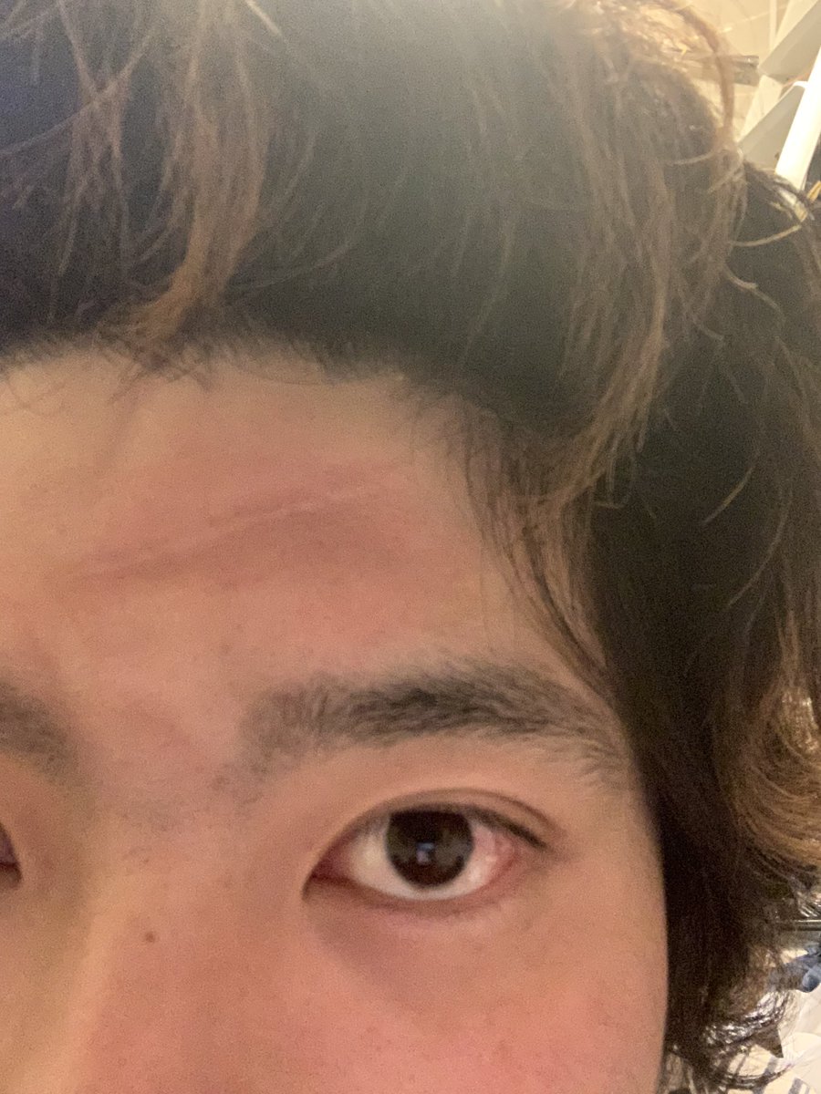 e_blue1219's tweet photo. エヴァおもろかった！

そいや朝寝相悪すぎておでこに傷みたいなんついてた笑 https://t.co/hw2s7AGOiS