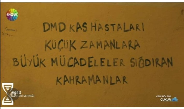 mnevverusta's tweet photo. #celasun
Dmd kas hastaları küçük zamanlara büyük mücadeleler sığdıran kahramanlar @cukurdizi https://t.co/OiKmetVRmE