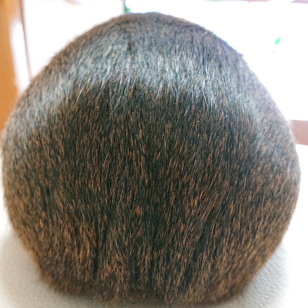 Yu Ta 仕事ばっかの毎日で禿げそう T Co Wdqkum1zoe Twitter