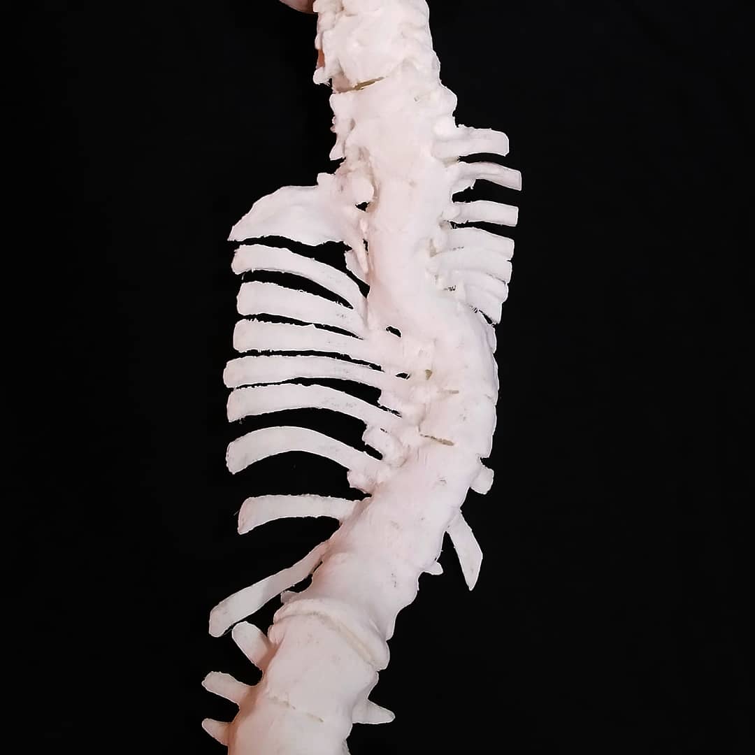 Impresión 3d de columna vertebral completa para estudio pre operatorio.
#3dmodel #3dprinting #spine #planificacionquirurgica #custom3dmodel #columnavertebral #medicaldevices #surgery #sanidad