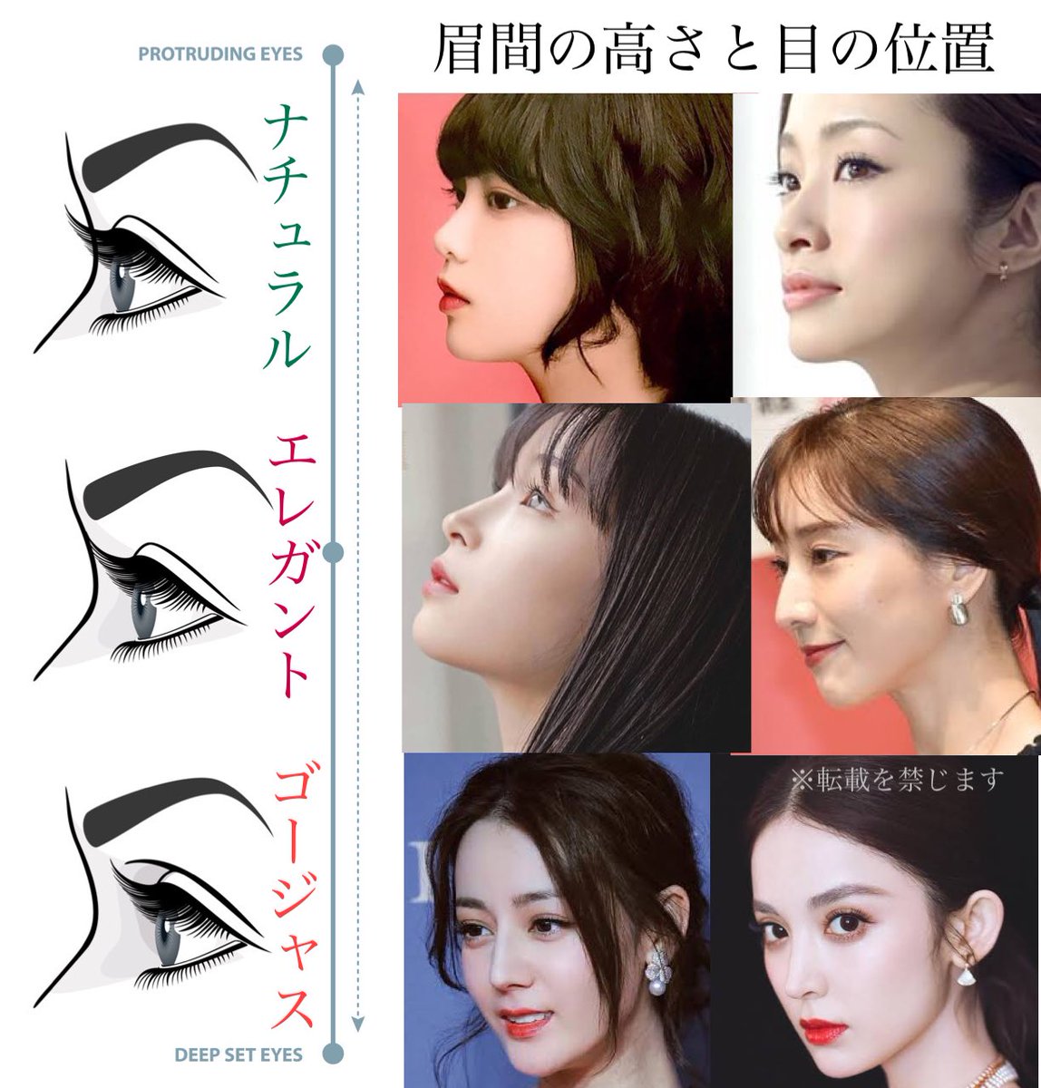 鼻プロテーゼ
