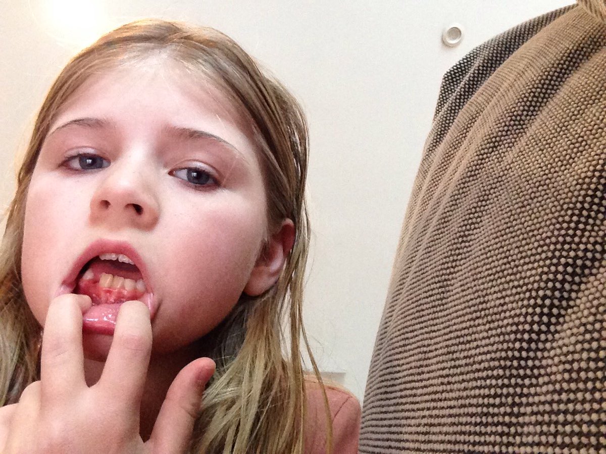 Christof Van Geendertaelen (@cvangeendert) on Twitter photo 