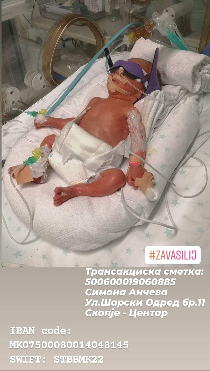 Дечкиии!! Се работи за бебенце на другарка. Јунакот побрза и се роди порано, во 28ма гестациска недела и е на респиратор во Систина. Доколку некој е во можност, нека донира. И по еден РТ ако не ви е тешко. Ви благодарам, останете во добро здравје. ❤️🍀