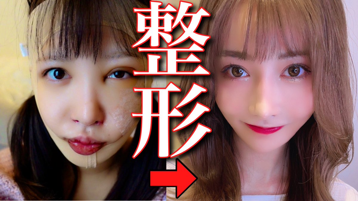 Rちゃん Rちゃん on X