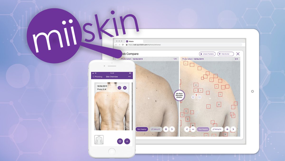 New app helps prevent skin cancer using #AI and #ML tek.io/3wDeMS3 by <a href="/KarenRoby6/">Karen GameStop</a> with <a href="/Jon_Friis/">Jon Friis</a> of <a href="/miiskinapp/">Online dermatologists and prescriptions | Miiskin</a> 

For more on Latest News, check out our Flipboard magazine, tek.io/2R0qXaW