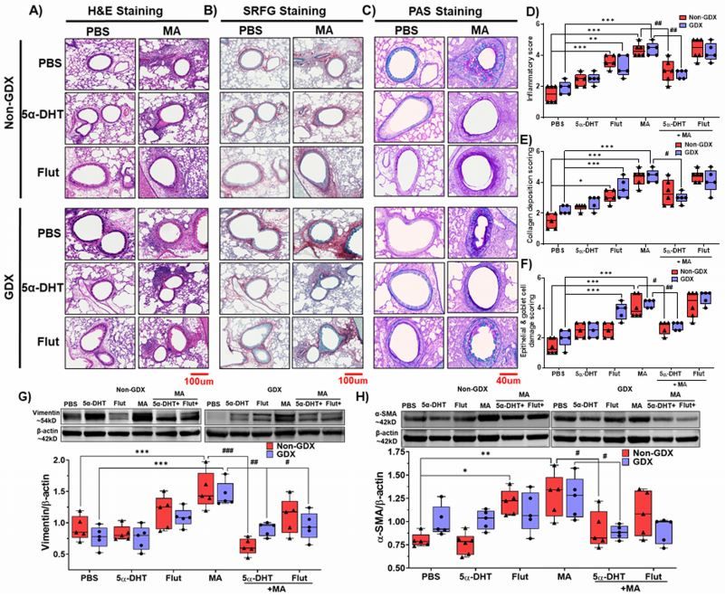AJPLung's tweet photo. New #ResearchArticle in AJP-Lung: #Androgen receptor activation alleviates airway hyperresponsiveness, #inflammation and remodeling in a murine model of #asthma. Read more here: https://t.co/OrrnVX7fug
#Flutamide #SexDifferences #SexSteroids #LungFunction https://t.co/WbJ5OMywDd