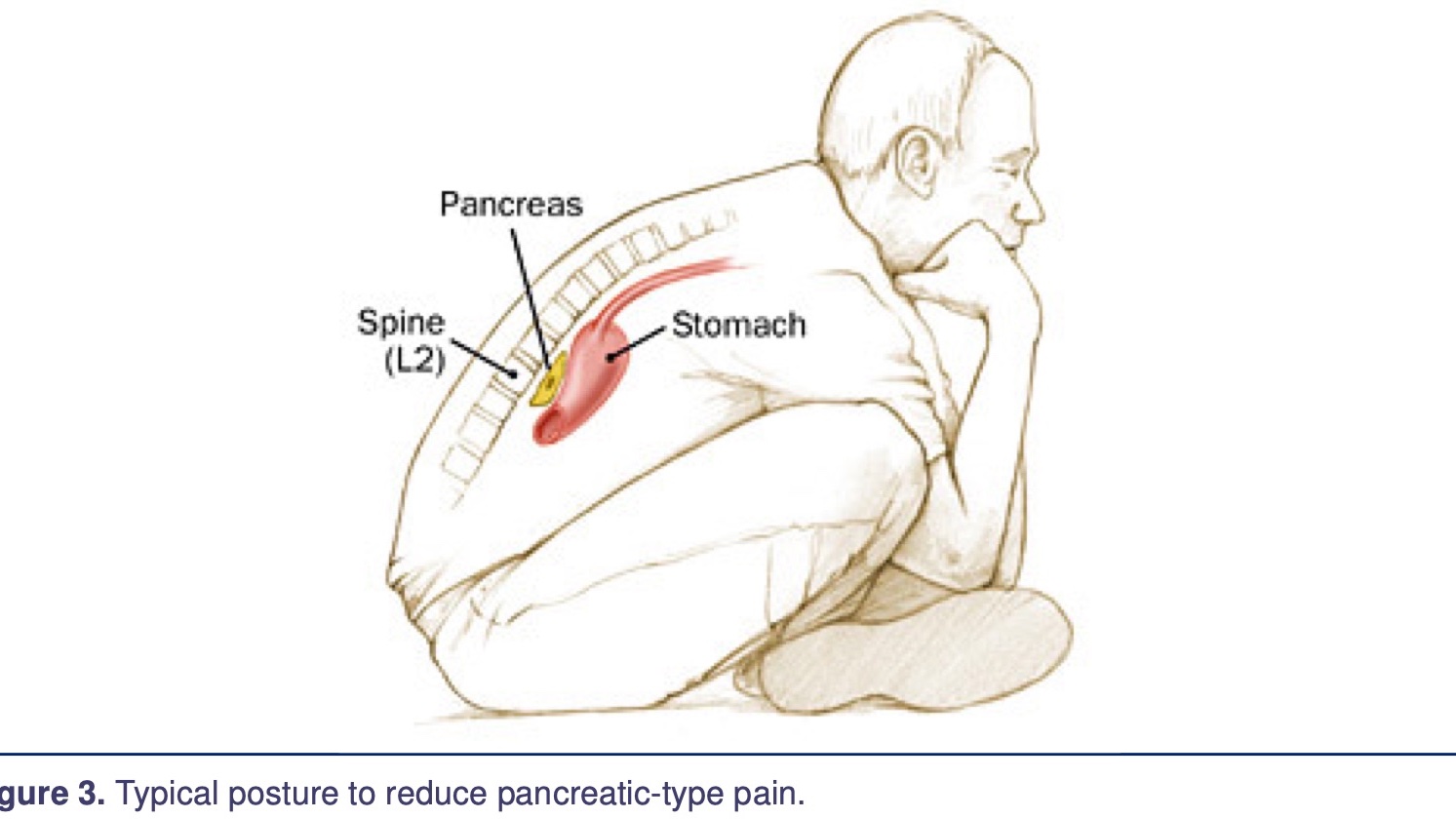 Pancreas Pain Location pancreas-pain-location