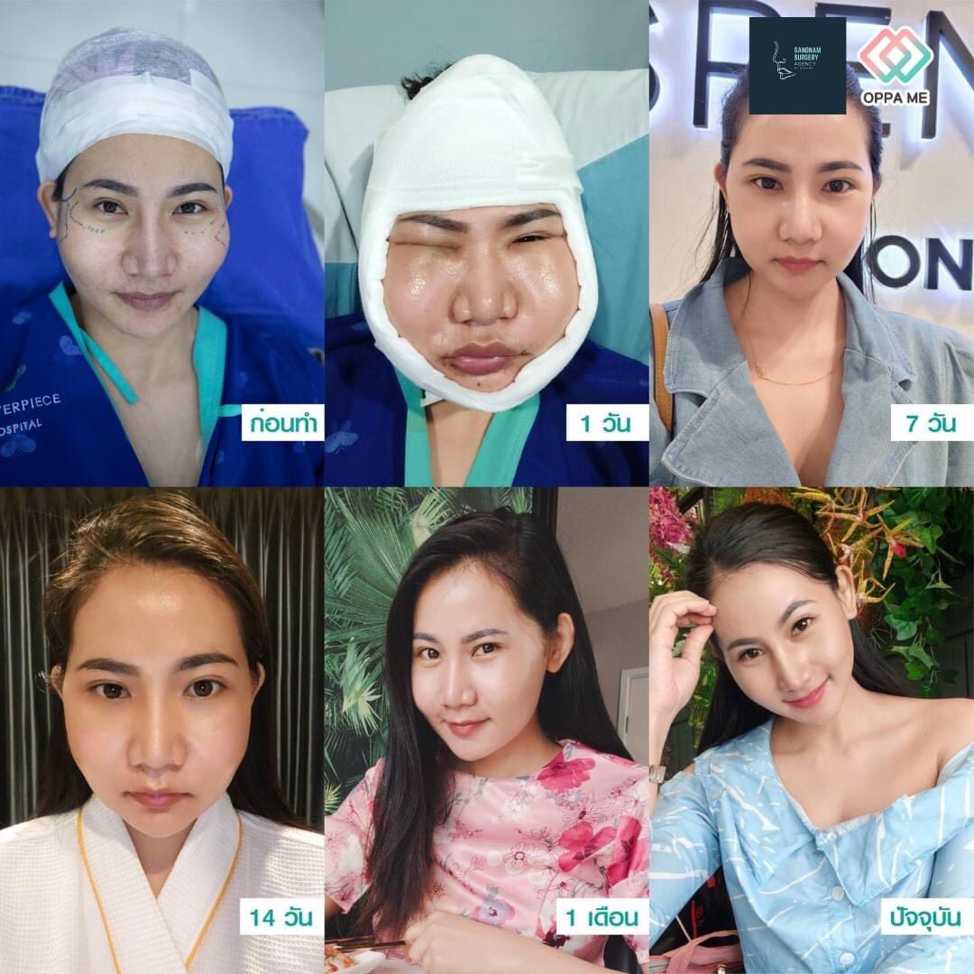 Gangnamagency7824 on Twitter: Gangnamagency7824 On Twitter: