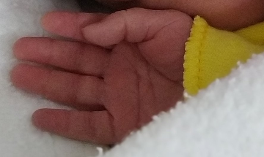 Aquí está la razón d mi existencia a partir d ahora 🥰

Carmen quiso venir al mundo 3 semanas antes d lo previsto, pero todo ha salido genial tanto para mí como para ella 😍 (1-4-21)
Es preciosa y muy buena 🤤

#esclerosismúltiple 0 - Jessica 1 💪

Ya he comenzado con #tysabri