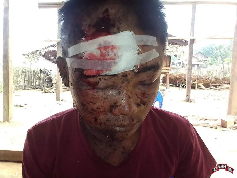 myradah's tweet photo. Vicious cycle! #FourCuts strategy was designed for inland counterinsurgency operations which is now upgraded to #AirStrike & #Bombing operations as brutal offensive against #EthnicArmedGroups continue & #Civilians suffer most. @FreeBurmaRangrs @uscb
https://t.co/29Zy2XPxUt https://t.co/DJjh9jefVr