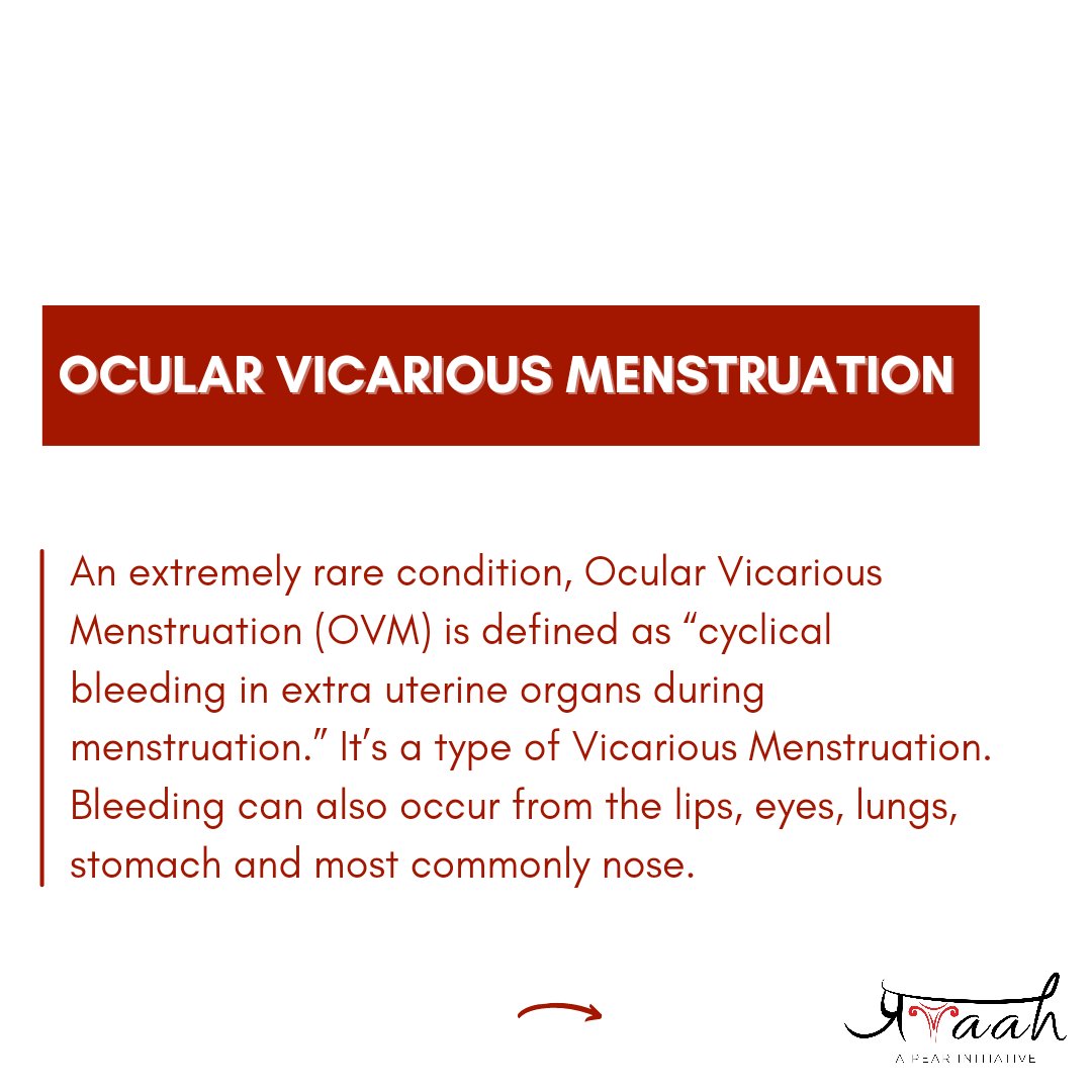 project_pravaah's tweet photo. Women cries tears of blood during menstruation due to a rare condition - Ocular Vicarious Menstruation.
#VicariousMenstruation
#RedTears
#Pravaah
#LetsTalkMenses https://t.co/kZOIfpkPWP