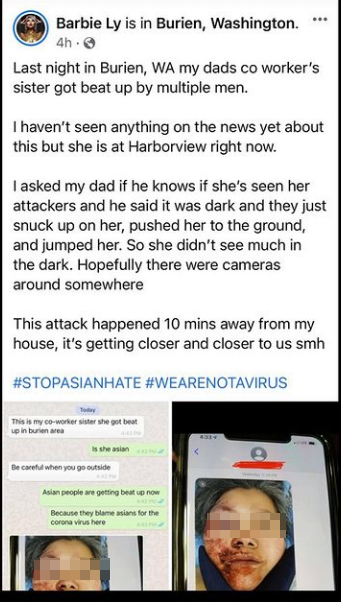 HopClear's tweet photo. Facebook user said Asian woman was jumped in Burien, Washington https://t.co/3whnudob58