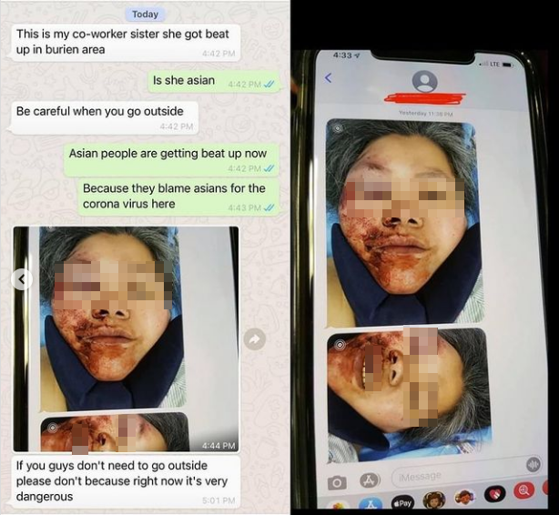 HopClear's tweet photo. Facebook user said Asian woman was jumped in Burien, Washington https://t.co/3whnudob58