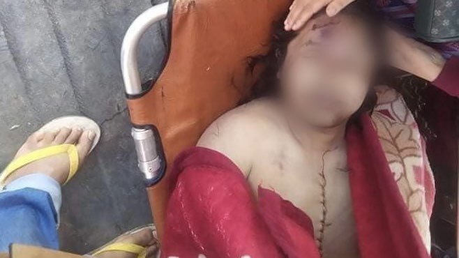 #Apr6Coup 

DEATH IN CUSTODY: 

Aung Paing (30 years old) arrested by SAC for trying to put out the fire in Nyaung Phyu Ward. 

BODY OPENED. 

#WhatsHappeningInMyanmar