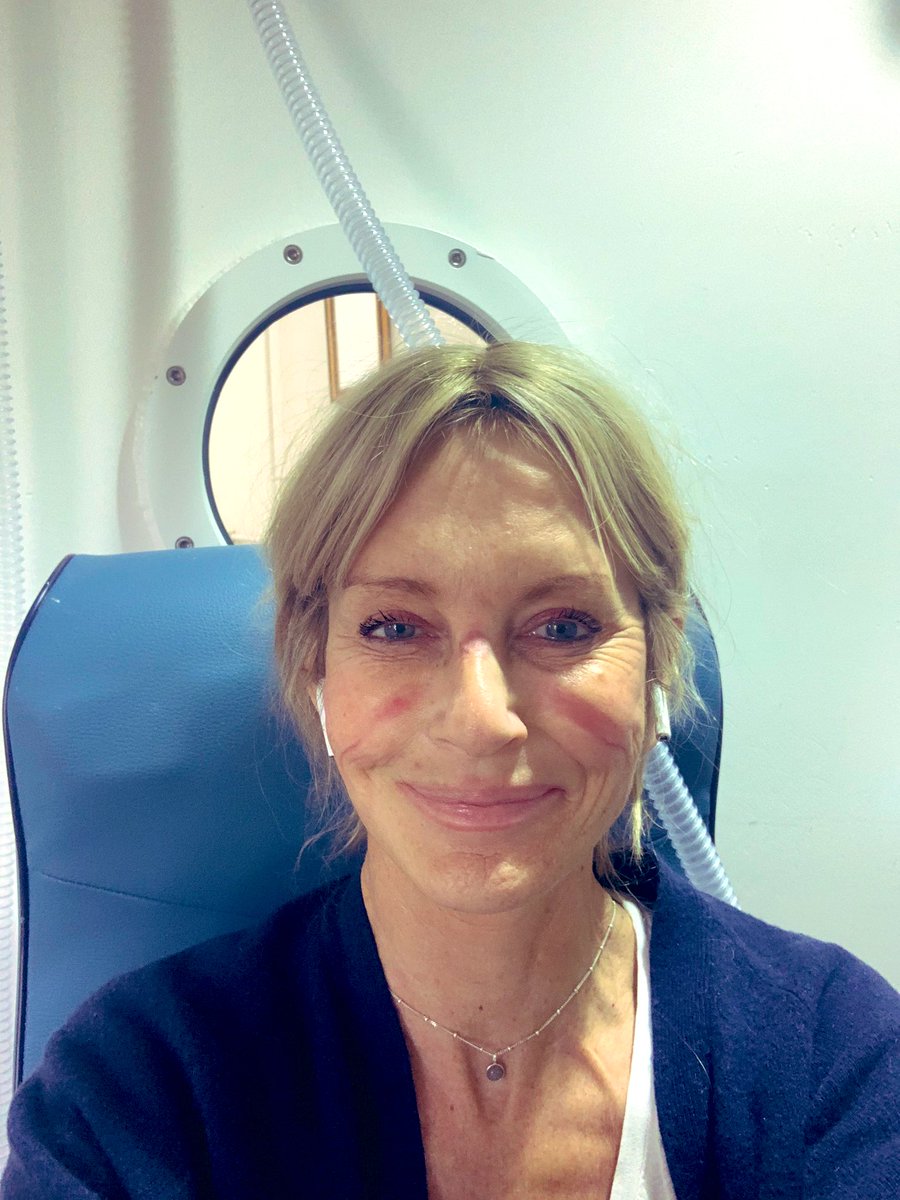SkyJacquie's tweet photo. Today was health appointments all over the place. 1st Oxygen therapy - ‘during’ & ‘after’ - hours later indentations are still impressive 👌😳#O2 #alternativetherapy Then the usual - blood tests in oncology 💉 think I’m good ..... for now 💪🏻🤞🍀 #itsafulltimejob #breastcancer https://t.co/7iZ58abdhg