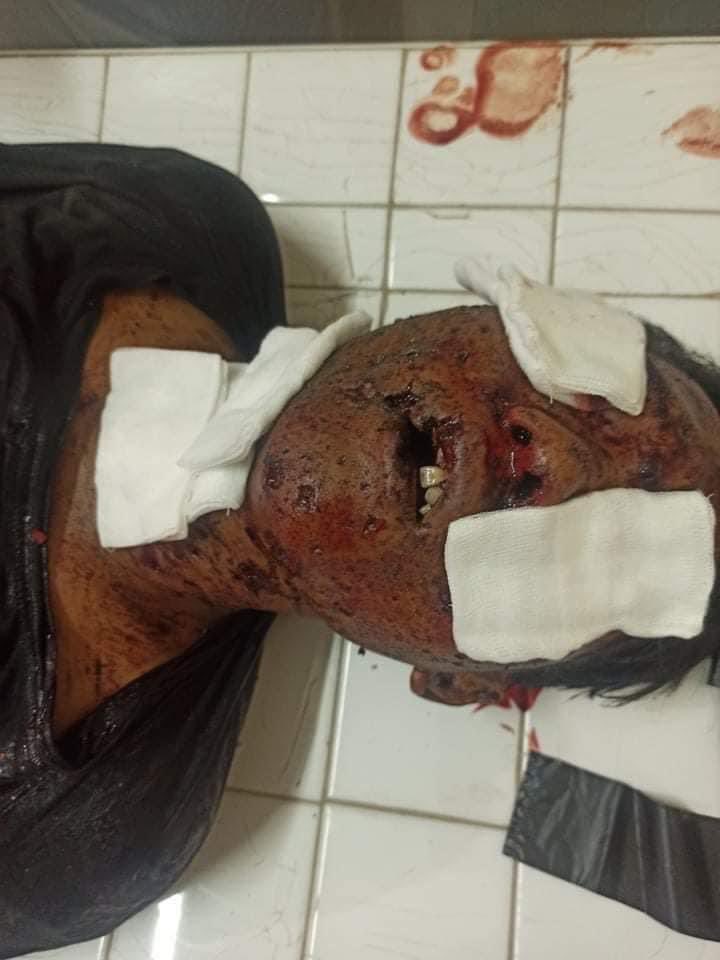 Rebel Military shot to Civilian with real bullets in Kaly ,Chin state Myanmar in early morning (05:00)am and (3)civilians died and one got serious injured. #WhatsHappeningInMyanmar #Apr7Coup. #UNHR https://t.co/rL9qdrRT7g