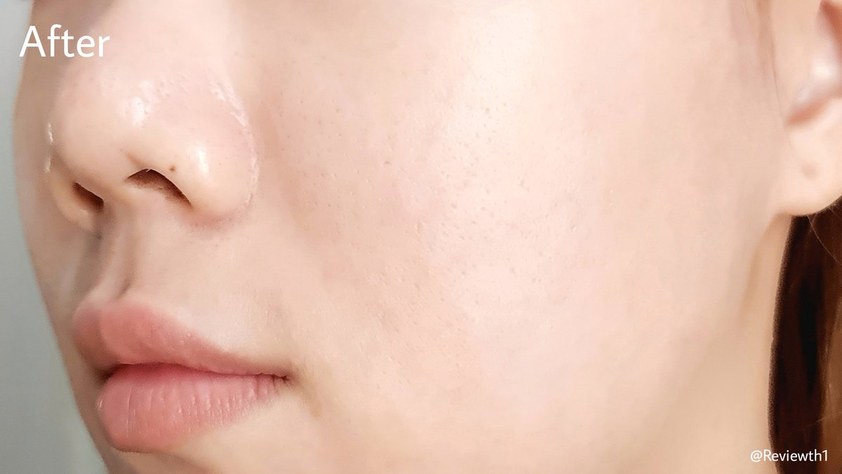 Reviewth1's tweet photo. ชอบอะไรที่เป็น 2in1 แบบนี้อะ มันใช้สะดวก ไม่เปลืองเวลา V pore minimizing Booster & cream สูตรใหม่ของ #Skinsista ใครยังไม่ลองต้องลอง กระชับรูขุมขนดีมักกก และยังช่วยผลัดเซลล์ผิวอ่อนๆ ลดการอุดตันตั้งแต่ต้นตอ เห็นแบบนี้เนื้อซึมไวเด้อ ไม่เหนอะ ไม่เป็นคราบเลย คุมมันด้วยนะ
#ใช้ดีบอกต่อ https://t.co/Y40awNAbmN