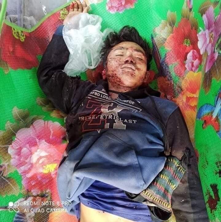 jessicalwin2's tweet photo. @TostevinM Today 8 people killed at Kale by Military. 5 dead bodies got it and the rest can’t get yet. Min Aung Hlaing said Military didn’t shoot by real gun so these bodies are joke? #WhatsHappeninglnMyanmar #April7Coup 
#WeNeedR2PInMyanmar https://t.co/fI5p6N4WOD