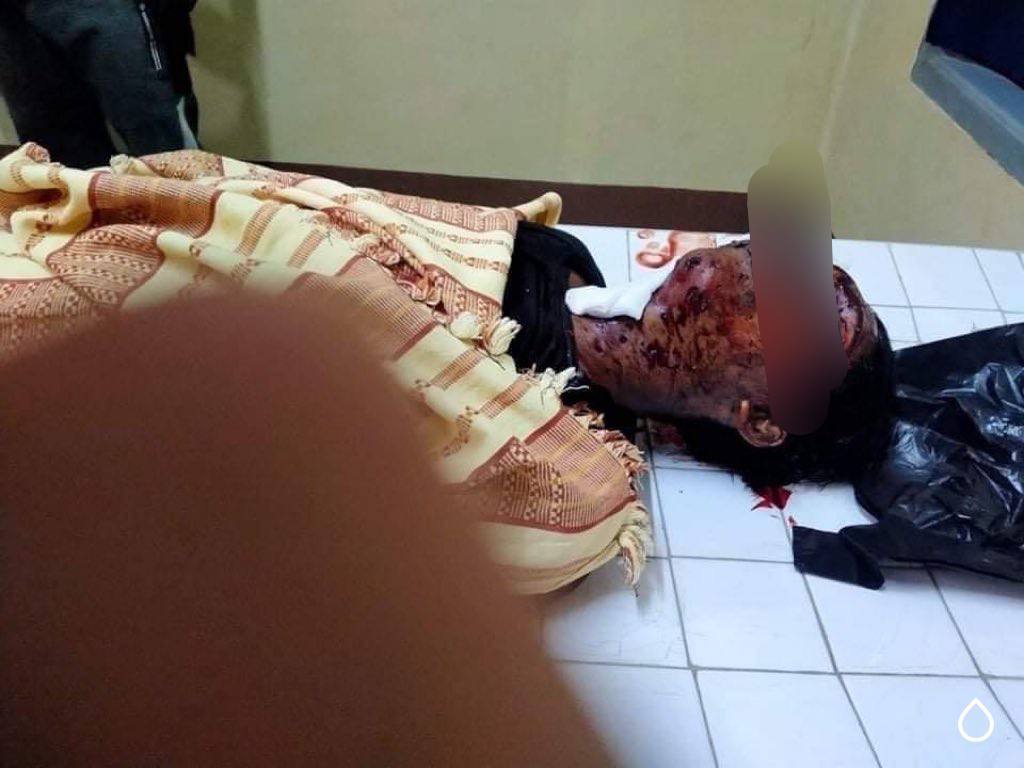 yadanar_ymk's tweet photo. tw // blood // death
In Kalay, military terrorists used RPG on unarmed citizens inhumanely. 5 people got shot dead and 8 got injured. They also raided the clinic and abducted injured people.
IMPLEMENT R2P
#Apr7Coup
#WhatsHappeningInMyanmar https://t.co/vNJPfm8NJN