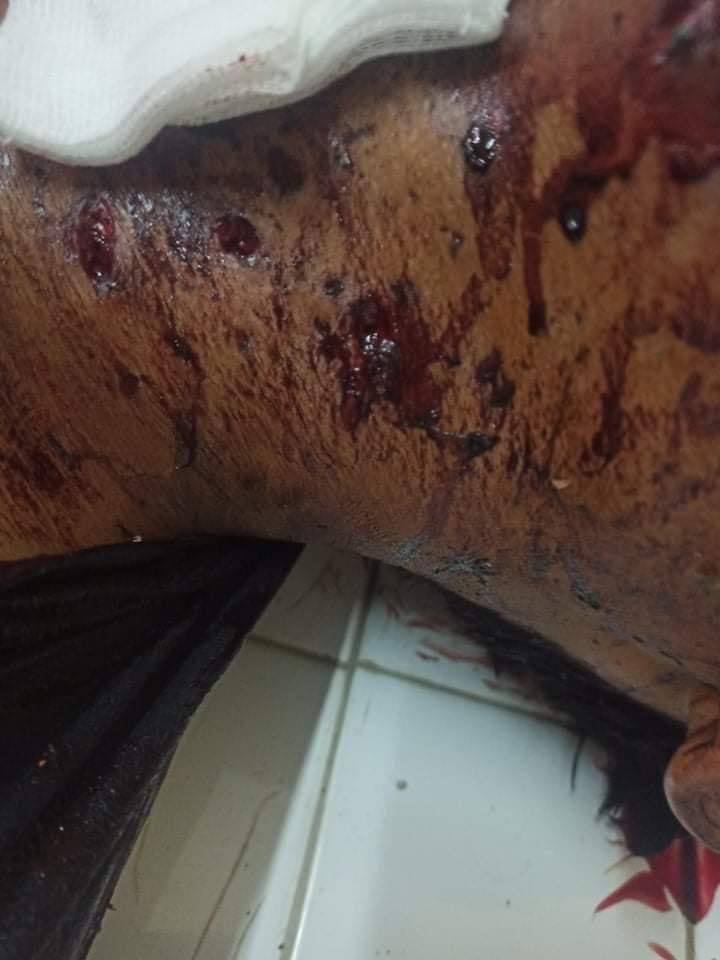 yadanar_ymk's tweet photo. tw // blood // death
In Kalay, military terrorists used RPG on unarmed citizens inhumanely. 5 people got shot dead and 8 got injured. They also raided the clinic and abducted injured people.
IMPLEMENT R2P
#Apr7Coup
#WhatsHappeningInMyanmar https://t.co/vNJPfm8NJN