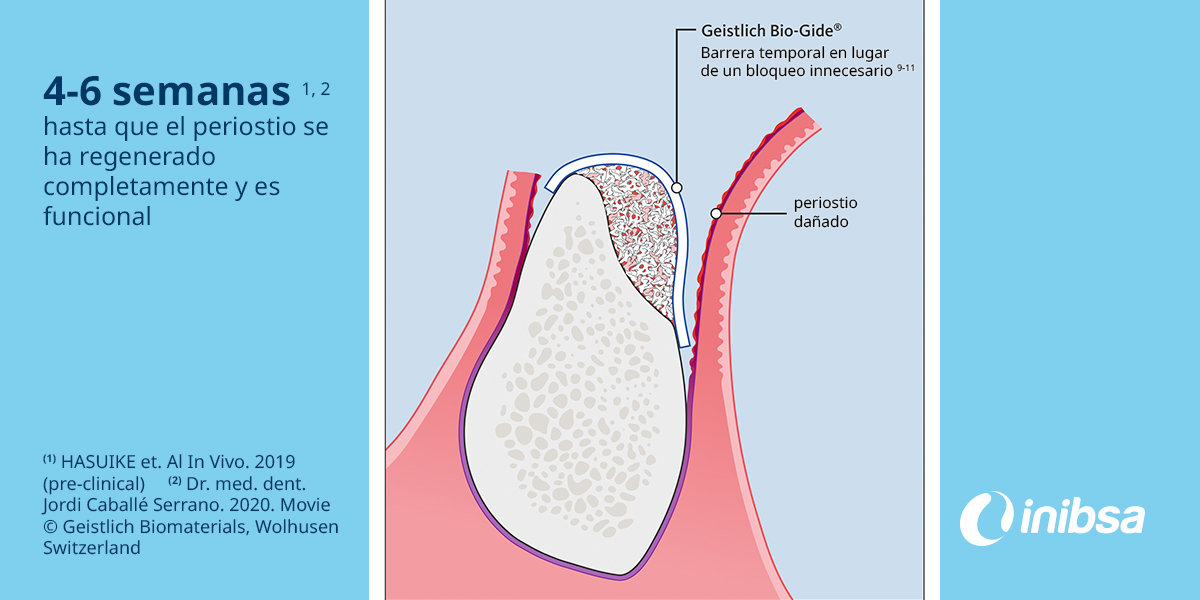 ¿Cuánto tiempo de barrera de una membrana necesitas?

El Dr. <a href="/jordicabser/">Jordi Caballé</a> nos recuerda que puedes utilizar una membrana natural de colágeno, ya que el tiempo de barrera garantiza su buena función. 😉 

✨¡Permite que el peritoneo se regenere y forme el hueso nuevo! ✨

#Inibsa