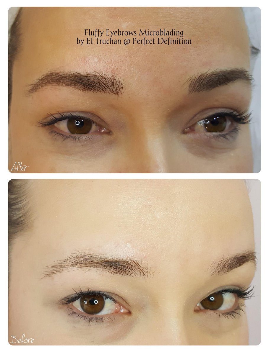 ElTruchan's tweet image. Fluffy Eyebrows Microblading by El Truchan @ Perfect Definition

#permanenteyebrowtattoo #digitalmicroblading #hairstrokes #browqueen #browformation #nanoblading #nano-blading #microfeathering #microshading #kbpro  #completeyebrows