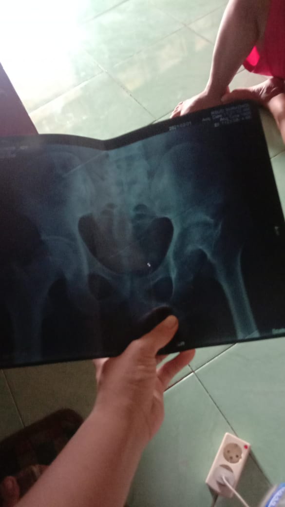 Saya tipe yg kurang suka diatur dan tradisionalisme jadi ya gak betah kerja di kantor akhirnya fokus di bidang yang di minati..fokus pengobatan tradisional fokus pemulihan saraf terjepit