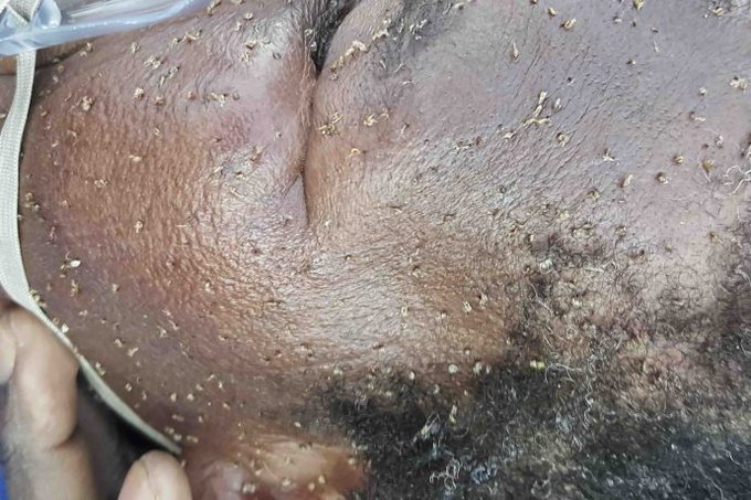 _ArriveAlive's tweet photo. Safety of Road Users from Bee Stings https://t.co/2Sb8BK1WlW #ArriveAlive #BeeAttacks https://t.co/4o4Sfq2zb3