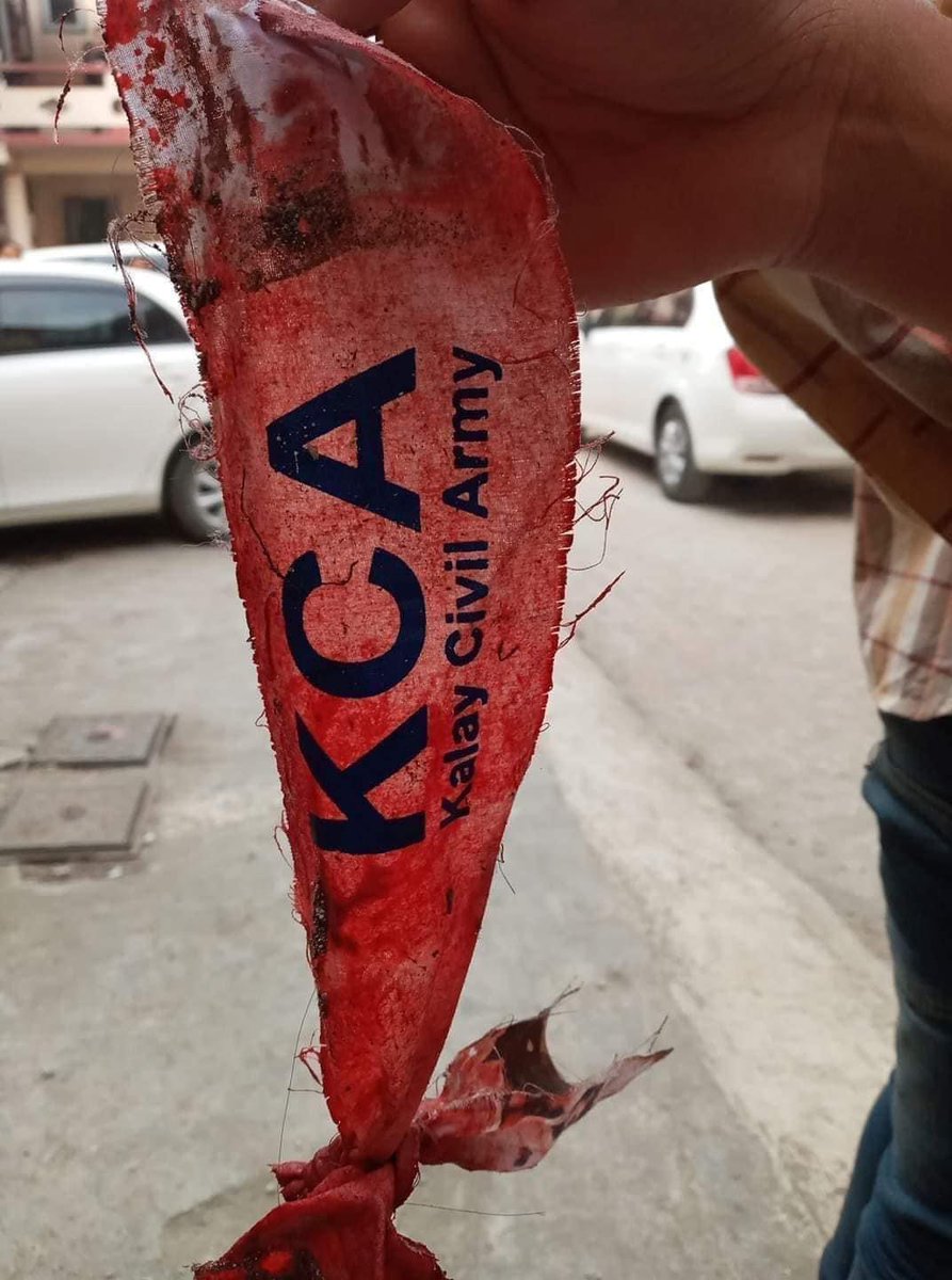 tayza19's tweet photo. @TostevinM #WhatsHappeninglnMyanmar #SaveMyanmar #WeNeedR2PInMyanmarImmediately #RejectMyanmarMilitaryCoup #Apr7Coup #Kalaymyo #KalayCivilArmy @RapporteurUn @SchranerBurgen1 @MayWongCNA @DrSasa22222 https://t.co/W4zT51bzg7