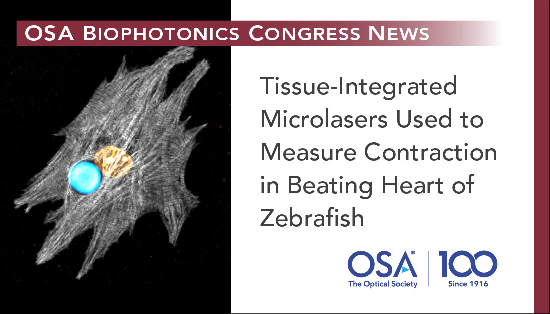 OpticaWorldwide's tweet photo. At #OSABiophotonics21, @univofstandrews researchers will demonstrate that #microlasers integrated into heart muscle can measure contraction in beating heart of zebrafish. Presented 14 April at 11:30 PDT.
Read more - https://t.co/Uk436HMd31 & register - https://t.co/k1sjwnifKC https://t.co/FqTeTM6Tf5